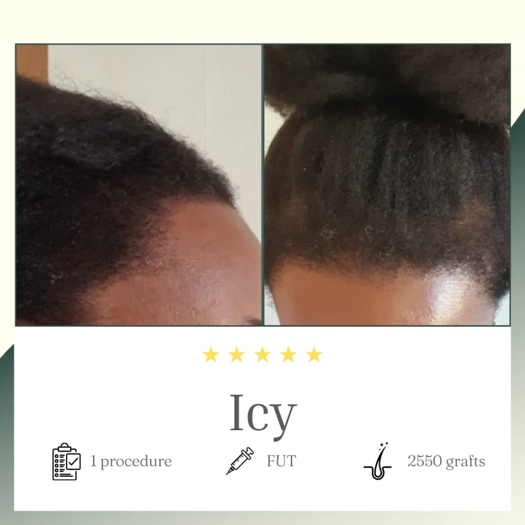 FUT 2550 - iCY