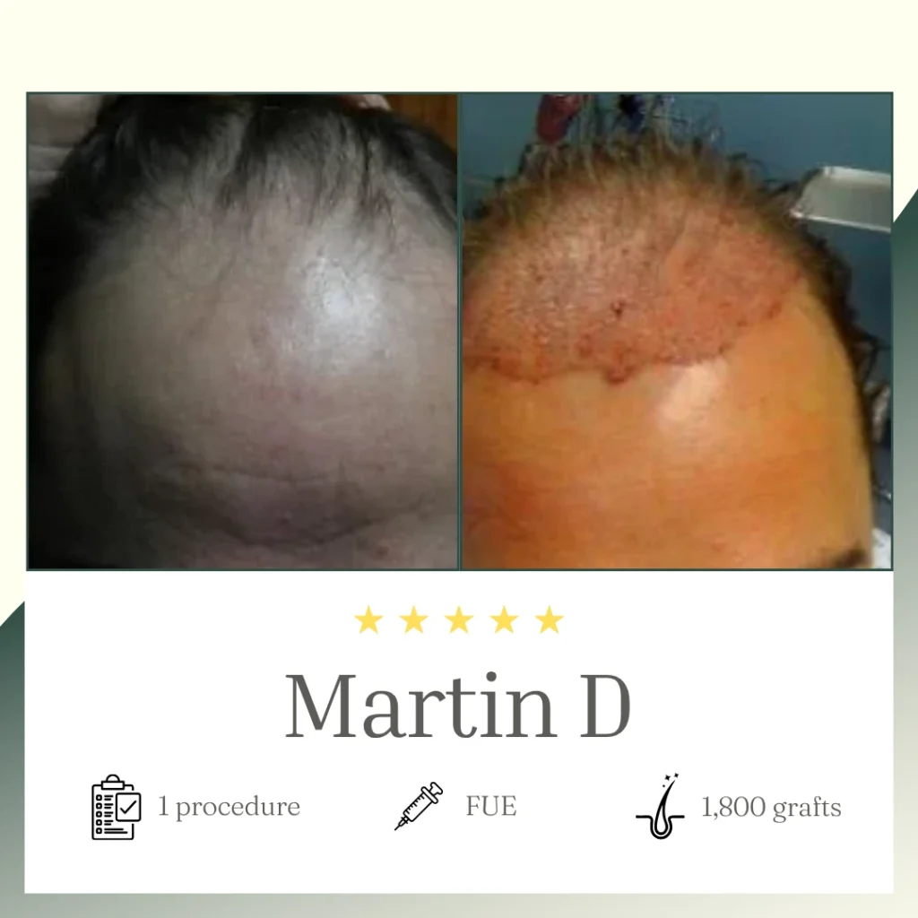 Martin D