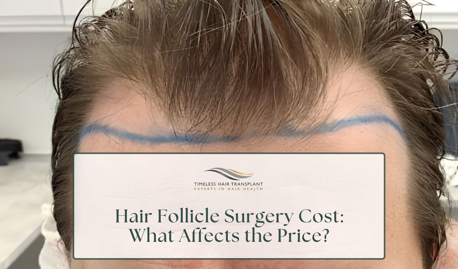 Hair Follicle Surgery Cost What Affects the Price