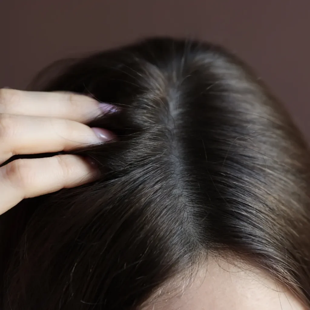 Hair Plus™ Aftercare for Enhanced Growth - Timeless hair transplant