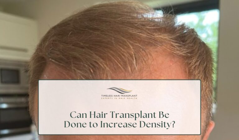 Can Hair Transplant Be Done to Increase Density