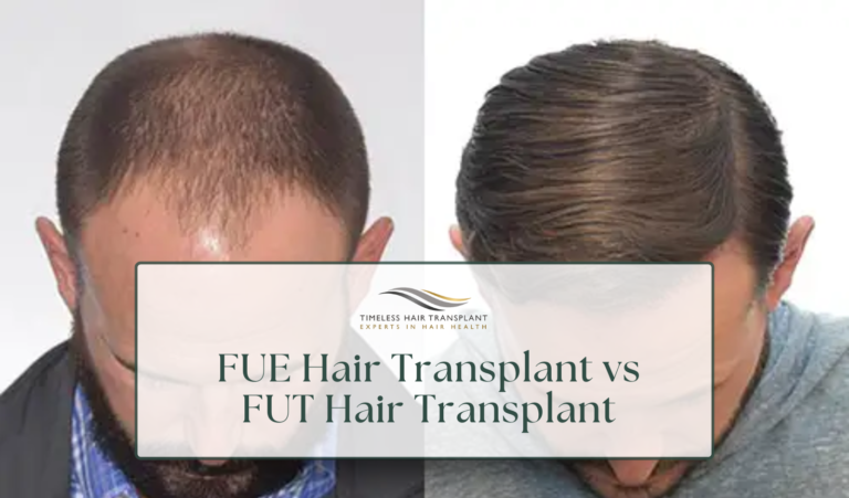 FUE Hair Transplant vs FUT Hair Transplant