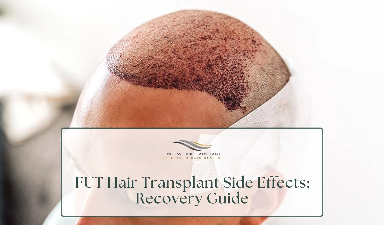 FUT Hair Transplant Side Effects Recovery Guide