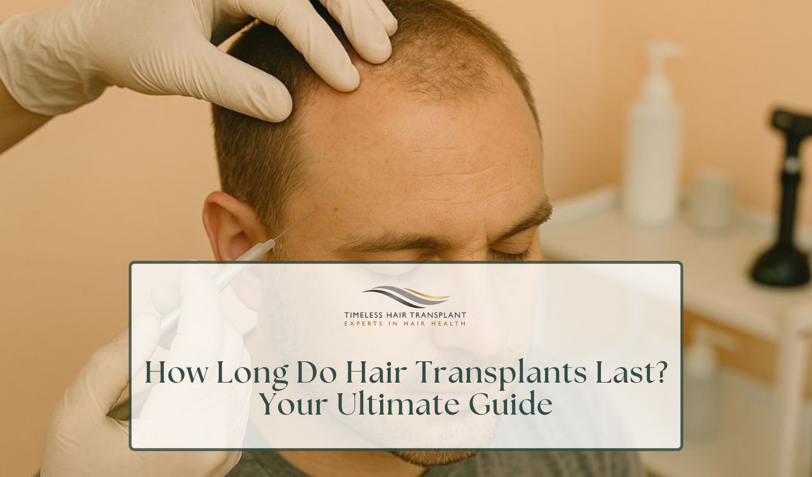 How Long Do Hair Transplants Last Your Ultimate Guide