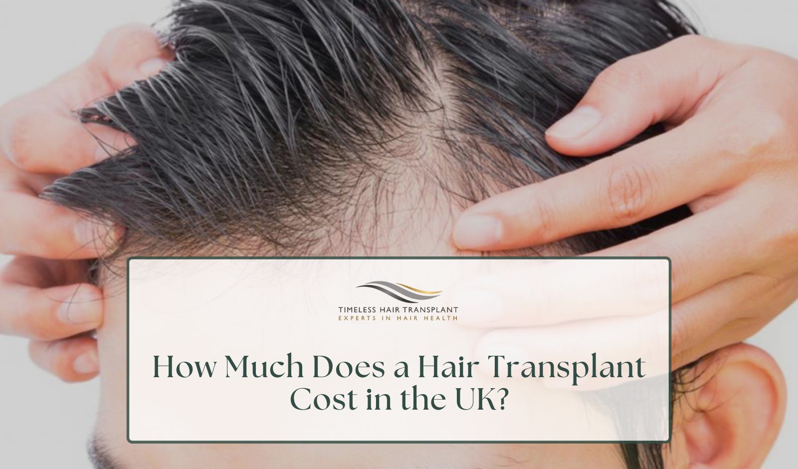 How Much Does a Hair Transplant Cost in the UK how much for hair transplant