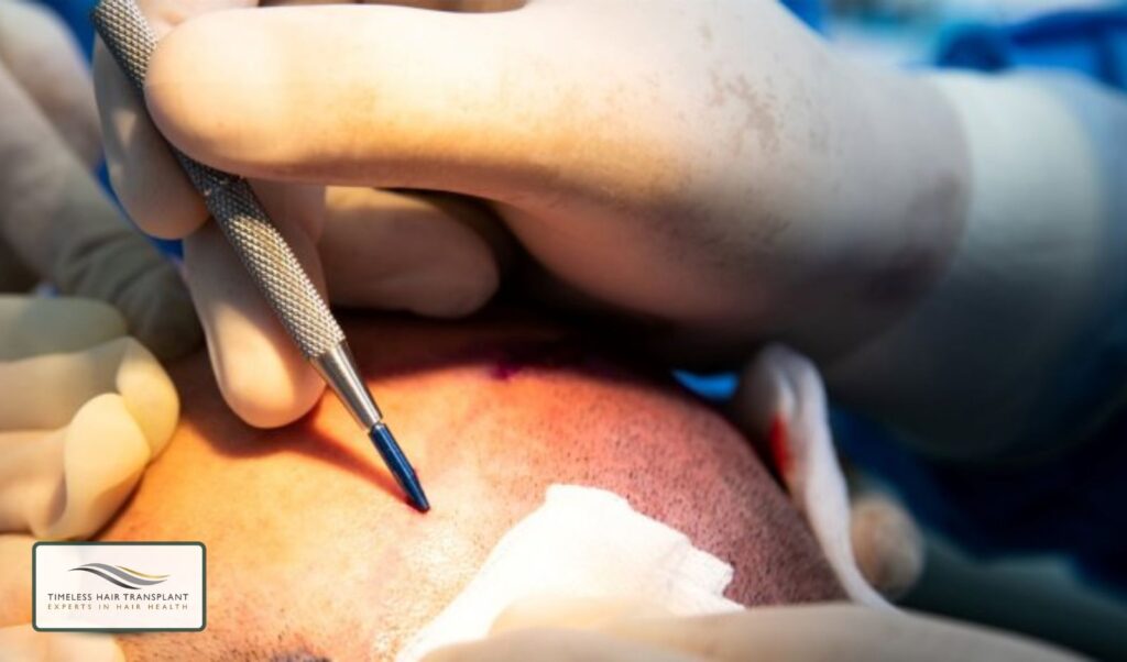 Is a Hair Transplant Painful
