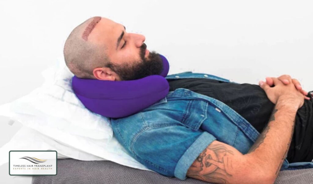 Managing Hair Transplant Pain After FUE