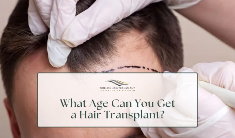 What Age Can You Get a Hair Transplant