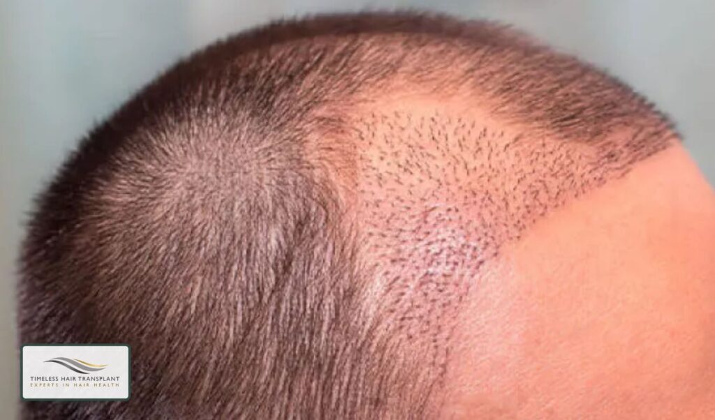 What Can Affect Long-Term Results